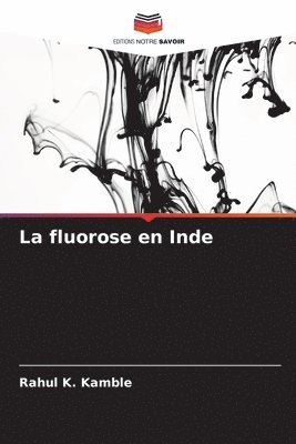 Rahul K Kamble, Rahul K. Kamble - fluorose en Inde, Häftad