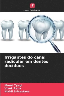 Mansi Tyagi, Vivek Rana, Nikhil Srivastava - Irrigantes do canal radicular em dentes decíduos, Häftad