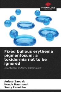 bokomslag Fixed bullous erythema pigmentosum