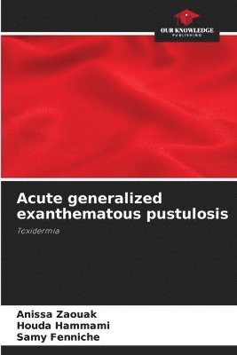 bokomslag Acute generalized exanthematous pustulosis