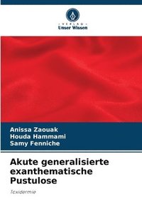 bokomslag Akute generalisierte exanthematische Pustulose