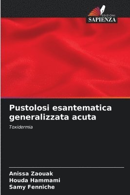 Pustolosi esantematica generalizzata acuta 1