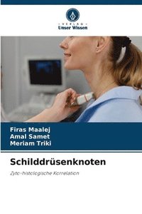 bokomslag Schilddrüsenknoten