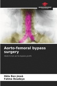 bokomslag Aorto-femoral bypass surgery