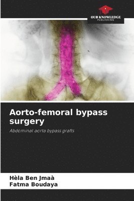 Aorto-femoral bypass surgery 1