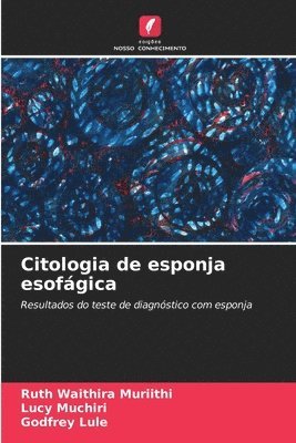 Citologia de esponja esofgica 1