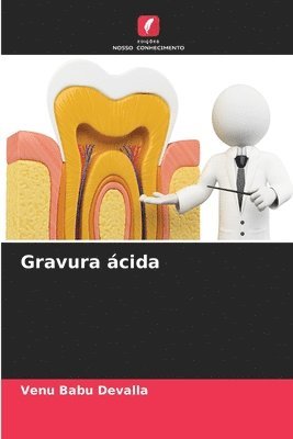 Gravura ácida