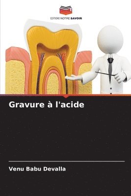 Gravure  l'acide 1