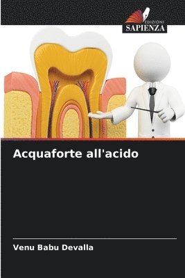 Venu Babu Devalla - Acquaforte all'acido, Häftad