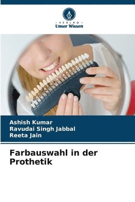 Farbauswahl in der Prothetik