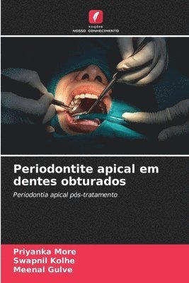 bokomslag Periodontite apical em dentes obturados