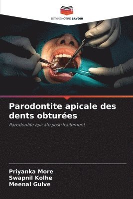 Parodontite apicale des dents obturées