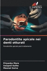 bokomslag Parodontite apicale nei denti otturati