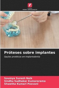 bokomslag Prteses sobre implantes