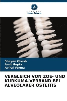 bokomslag Vergleich Von Zoe- Und Kurkuma-Verband Bei Alveolarer Osteitis