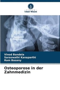 bokomslag Osteoporose in der Zahnmedizin