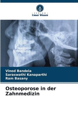 Osteoporose in der Zahnmedizin 1