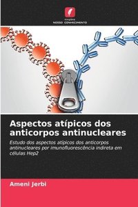 bokomslag Aspectos atípicos dos anticorpos antinucleares