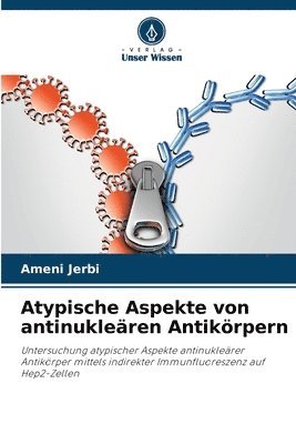 Ameni Jerbi, Ameni JERBI - Atypische Aspekte von antinukleären Antikörpern, Häftad