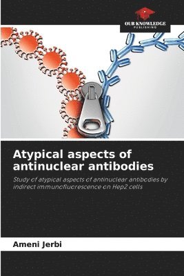 bokomslag Atypical aspects of antinuclear antibodies