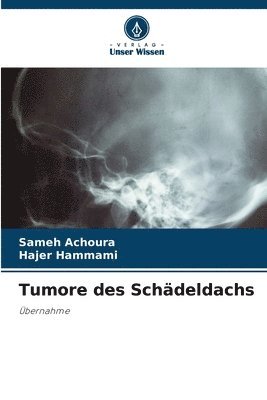 bokomslag Tumore des Schdeldachs