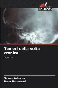 bokomslag Tumori della volta cranica