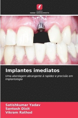 bokomslag Implantes imediatos