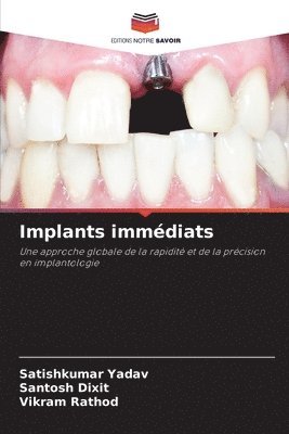 bokomslag Implants immdiats