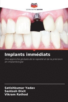 Satishkumar Yadav, Santosh Dixit, Vikram Rathod - Implants immédiats, Häftad