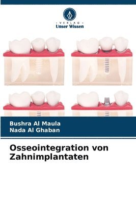 bokomslag Osseointegration von Zahnimplantaten