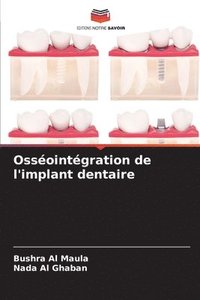 bokomslag Ossointgration de l'implant dentaire