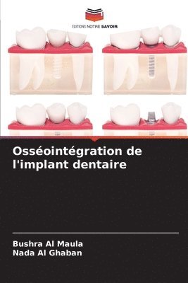 bokomslag Ossointgration de l'implant dentaire