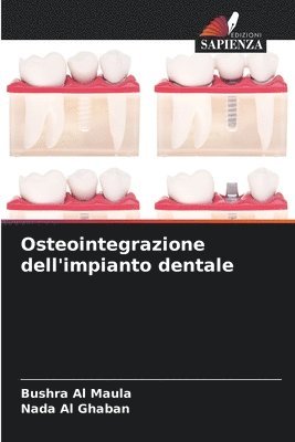 bokomslag Osteointegrazione dell'impianto dentale