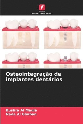 bokomslag Osteointegrao de implantes dentrios