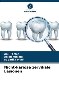 bokomslag Nicht-kariöse zervikale Läsionen