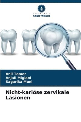 bokomslag Nicht-karise zervikale Lsionen