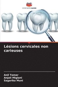 bokomslag Lésions cervicales non carieuses