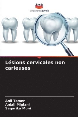 bokomslag Lsions cervicales non carieuses