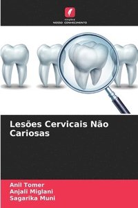 bokomslag Leses Cervicais No Cariosas