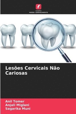 bokomslag Lesões Cervicais Não Cariosas