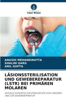 Läsionssterilisation Und Gewebereparatur (Lstr) Bei Primären Molaren 1