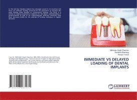 Immediate Vs Delayed Loading of Dental Implants 1