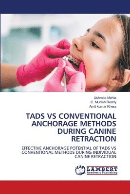 bokomslag Tads Vs Conventional Anchorage Methods During Canine Retraction