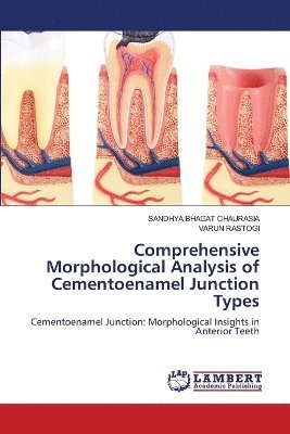 Sandhya Bhagat Chaurasia, Varun Rastogi, SANDHYA BHAGAT CHAURASIA - Comprehensive Morphological Analysis of Cementoenamel Junction Types, Häftad