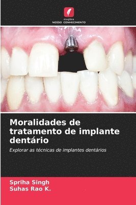 bokomslag Moralidades de tratamento de implante dentário