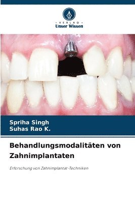 bokomslag Behandlungsmodalitäten von Zahnimplantaten