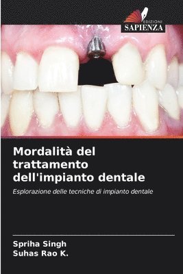 Spriha Singh, Suhas Rao K, Suhas Rao K. - Mordalità del trattamento dell'impianto dentale, Häftad