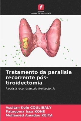 bokomslag Tratamento da paralisia recorrente ps-tiroidectomia