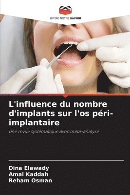 bokomslag L'influence du nombre d'implants sur l'os péri-implantaire