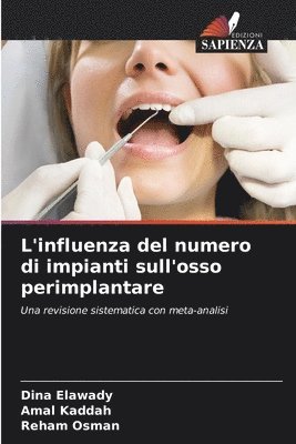 Dina Elawady, Amal Kaddah, Reham Osman - L'influenza del numero di impianti sull'osso perimplantare, Häftad